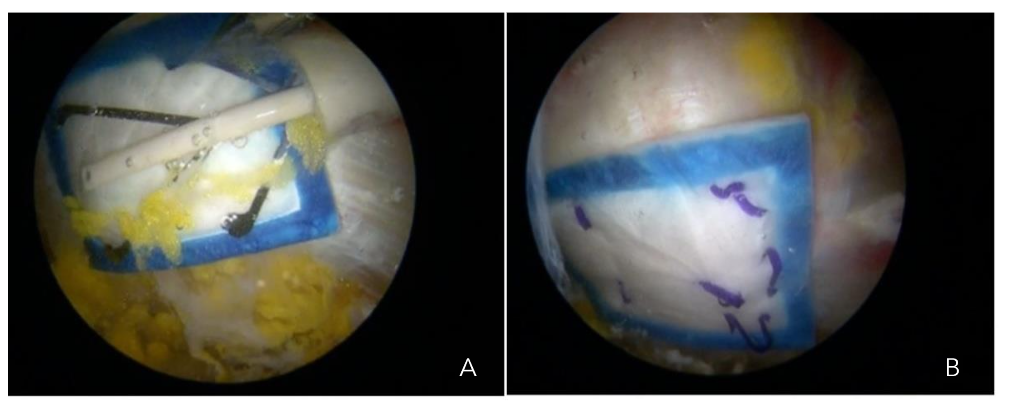 This image has an empty alt attribute; its file name is image-147.png