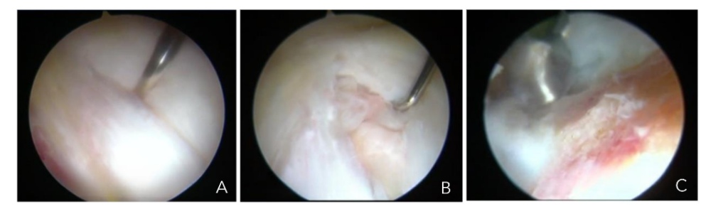 This image has an empty alt attribute; its file name is image-148-1024x294.png