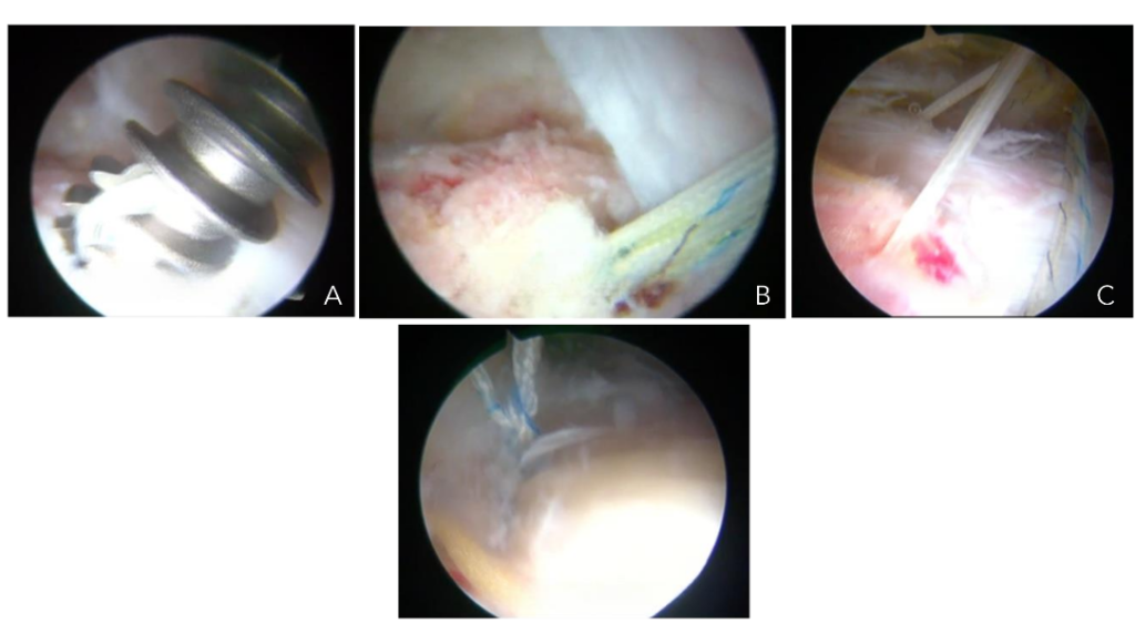 This image has an empty alt attribute; its file name is image-149-1024x562.png