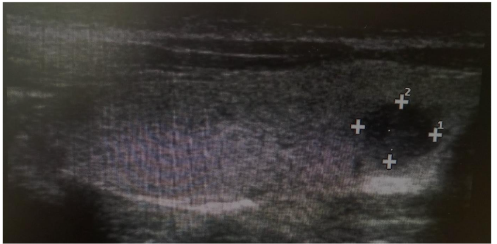 This image has an empty alt attribute; its file name is image-153-1024x503.png