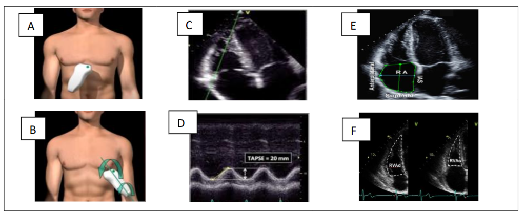 This image has an empty alt attribute; its file name is image-167-1024x416.png