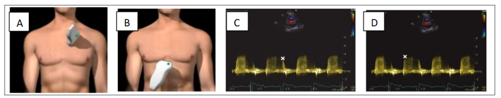 This image has an empty alt attribute; its file name is image-168-1024x202.png