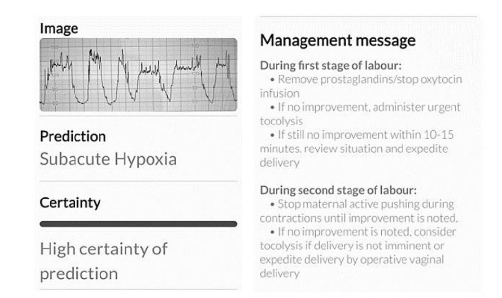 This image has an empty alt attribute; its file name is image-29-1024x608.png