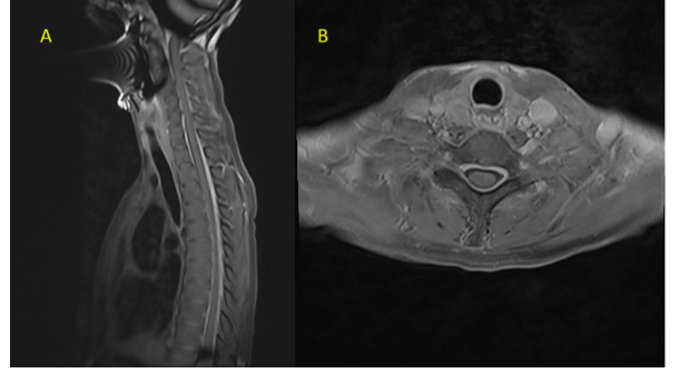 This image has an empty alt attribute; its file name is image-56.png