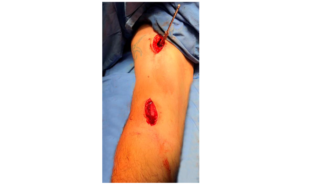 This image has an empty alt attribute; its file name is image-91.png