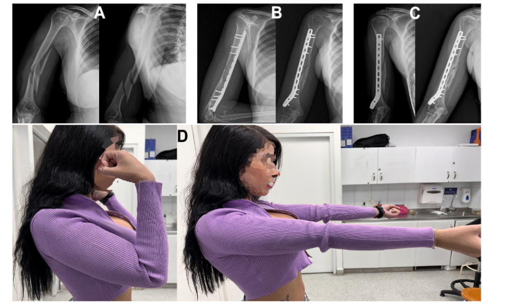 This image has an empty alt attribute; its file name is image-92-1024x615.png