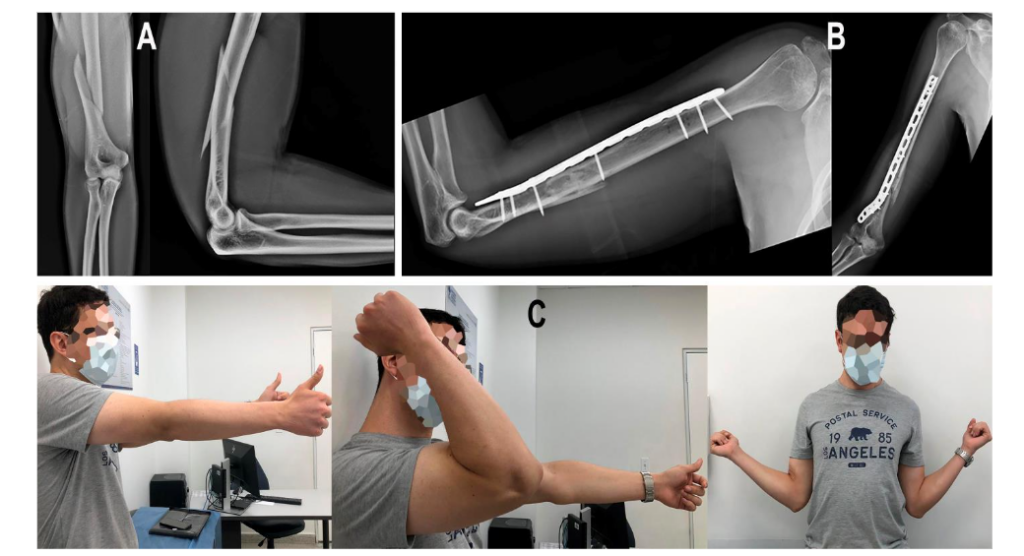 This image has an empty alt attribute; its file name is image-93-1024x556.png