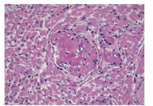 This image has an empty alt attribute; its file name is image-315.png