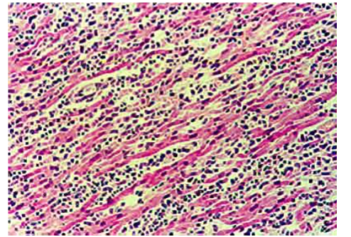 This image has an empty alt attribute; its file name is image-316.png