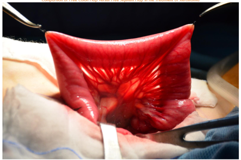 This image has an empty alt attribute; its file name is image-454.png