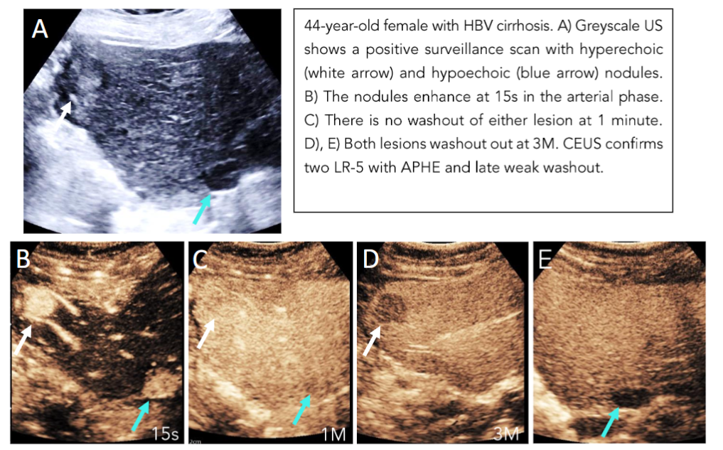 This image has an empty alt attribute; its file name is image-58.png