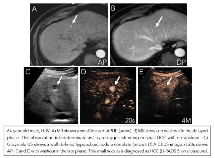 This image has an empty alt attribute; its file name is image-60.png