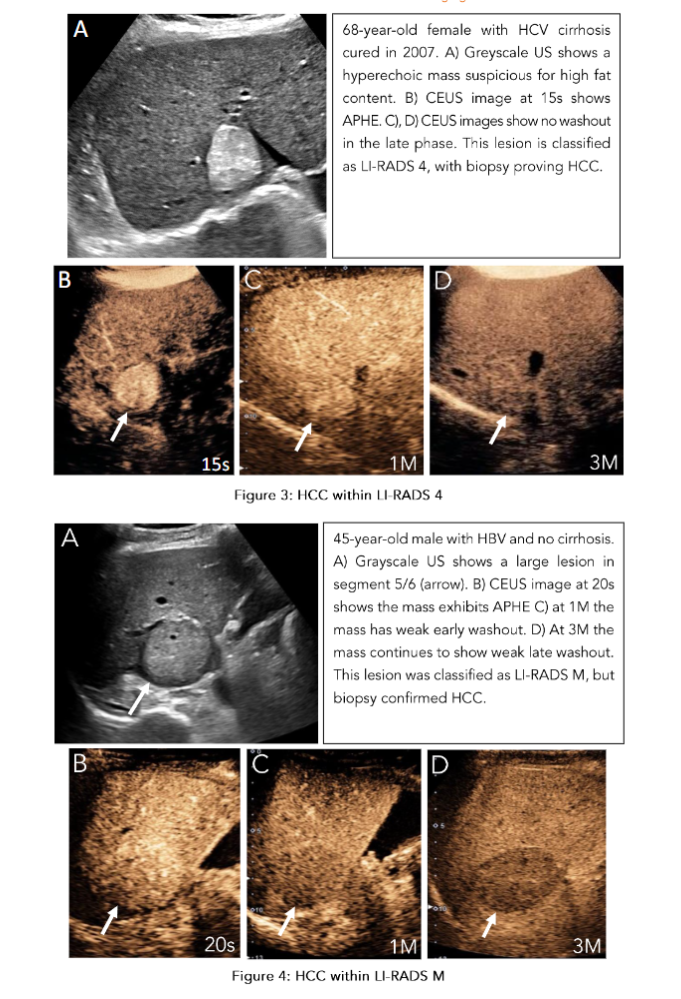 This image has an empty alt attribute; its file name is image-62.png