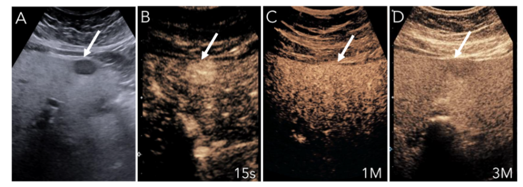 This image has an empty alt attribute; its file name is image-63-1024x367.png