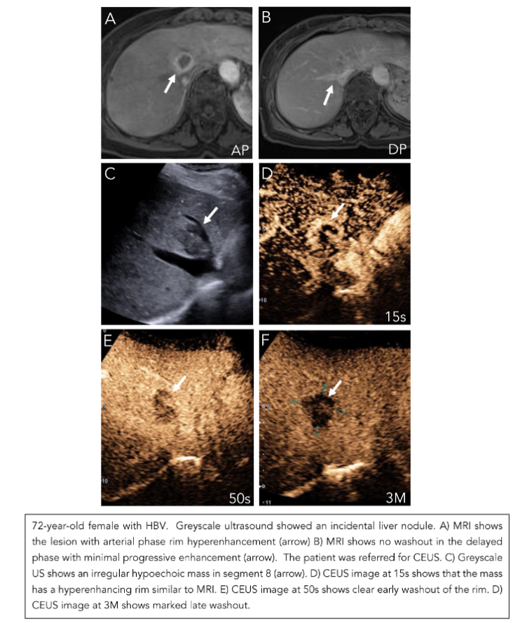 This image has an empty alt attribute; its file name is image-64.png