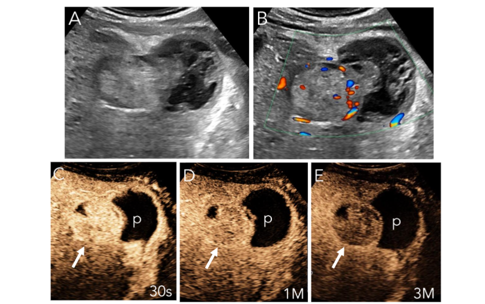 This image has an empty alt attribute; its file name is image-65.png