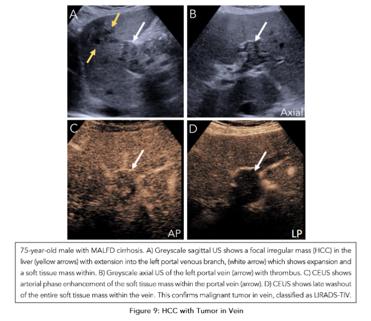 This image has an empty alt attribute; its file name is image-68.png