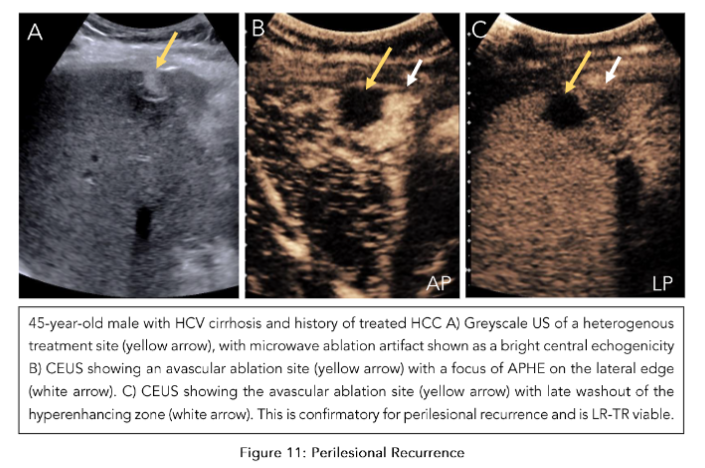 This image has an empty alt attribute; its file name is image-71.png