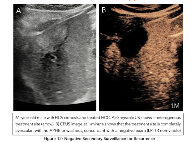 This image has an empty alt attribute; its file name is image-72.png