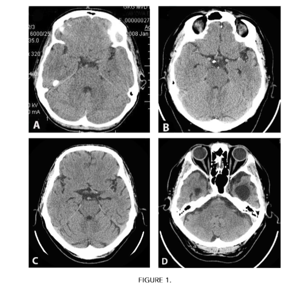 This image has an empty alt attribute; its file name is image-75.png